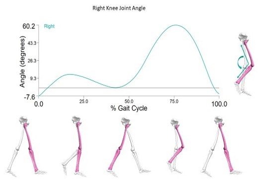 Gait cycle representation