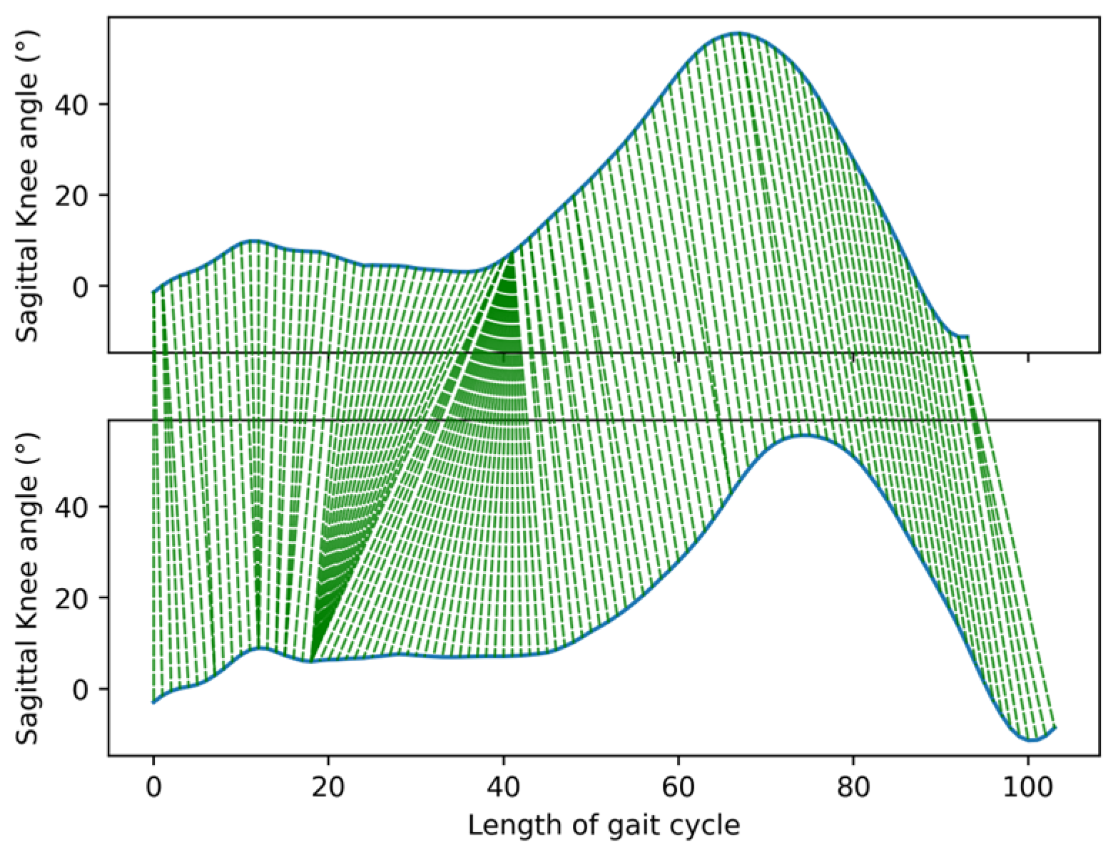 Temporal Alignment of Normal Gait Cycles via DTW